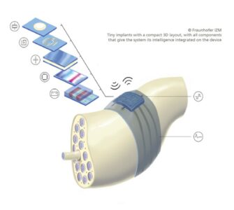 Bioelectronics, Fraunhofer_IZM