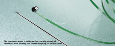 The new microcamera is no bigger than coarsely ground salt. Therefore, it fits perfectly into the endoscope tip. Awaiba GmbH. Fraunhofer IZM