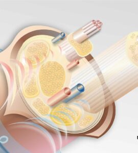 Neural Implant, Fraunhofer IZM