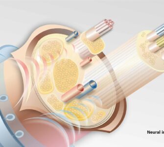 Neural Implant, Fraunhofer IZM