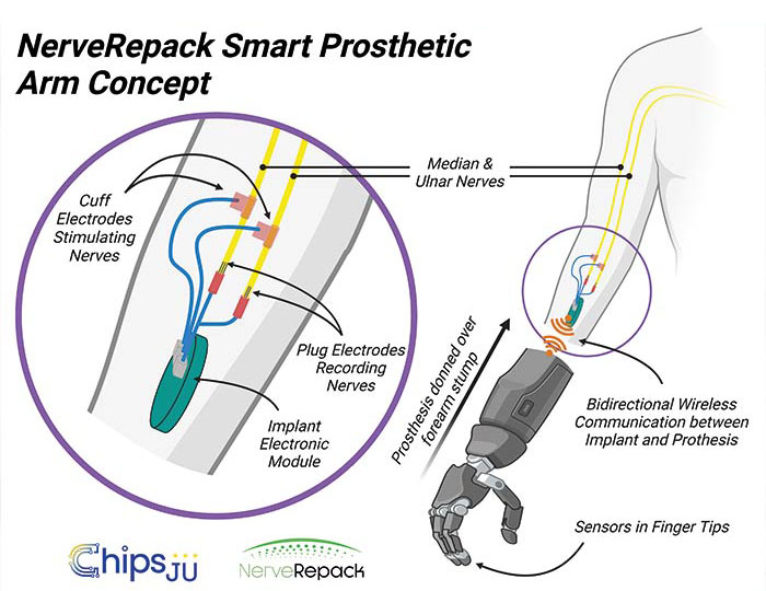 Die NerveRepack-Prothese wird in der Lage sein, drahtlos mit einem Implantat zu kommunizieren, das Signale an Nerven im Arm sendet und von diesen empfängt. Diese bidirektionale Kommunikation wird Patient*innen eine intuitivere Nutzung und eine größere Autonomie ermöglichen. Das Bild wurde mit Biorender.com erstellt. © Fraunhofer IZM